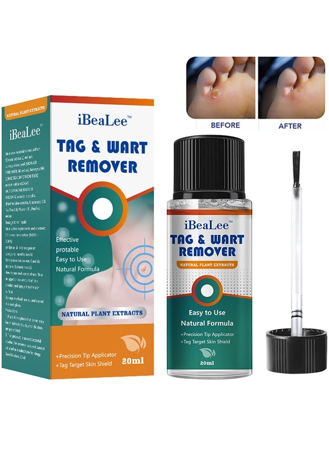 iBealee Natural & Safe Wart And Mole Remover Liquid, Wart Remover Liquid, Salicylic Acid Fast-Acting Formula For Plantar Warts, Skin Tags, Corns & Callus Removal, Pain-Free Scar-Free Treatment, Toes & Foot Care For Men & Women, 20ml - Image 1